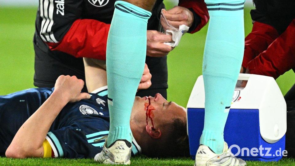 Joshua Kimmich liegt verletzt am Boden. Er konnte aber weiterspielen. Bild: Tom Weller/dpa