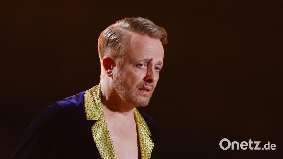 Ross Antony war sichtlich gezeichnet, nahm die Sache aber mit Humor. Bild: Rolf Vennenbernd/dpa