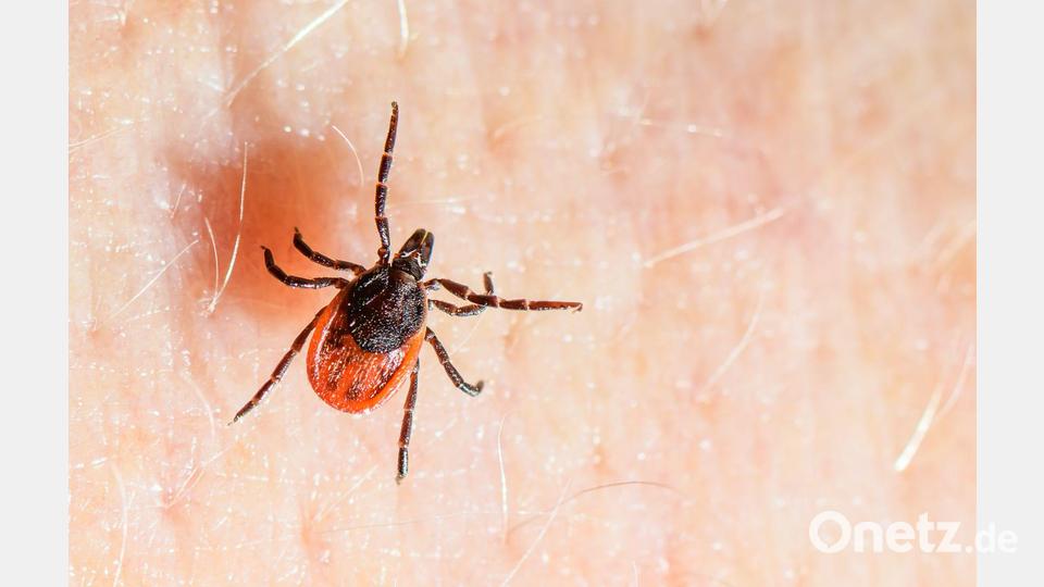 Der Gemeine Holzbock ist die häufigste Zeckenart in Deutschland und auch die, die hauptsächlich FSME und Borreliose auf den Menschen übertragt. Archivbild: Patrick Pleul/dpa