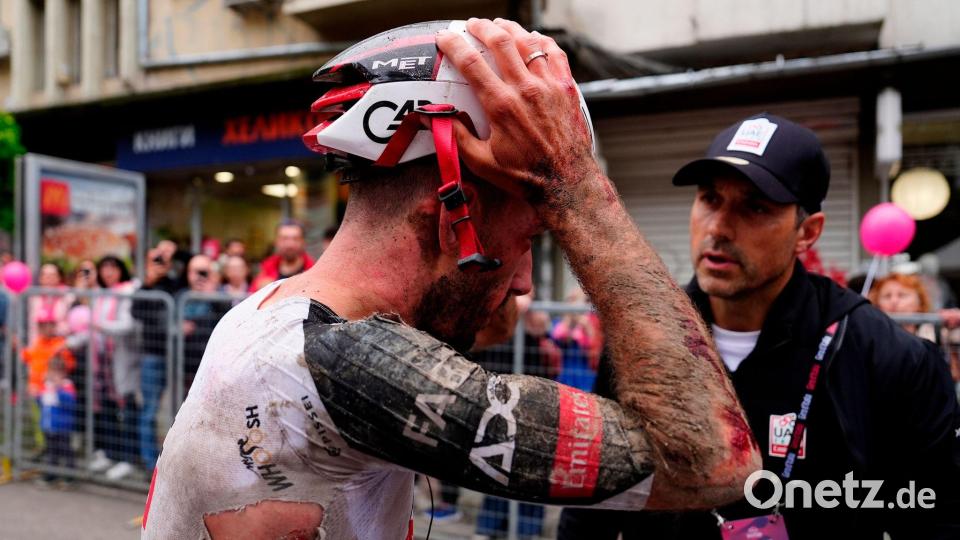 Mitfavorit Adam Yates stürzte beim Giro d'Italia schwer. Bild: Fabio Ferrari/LaPresse/AP/dpa