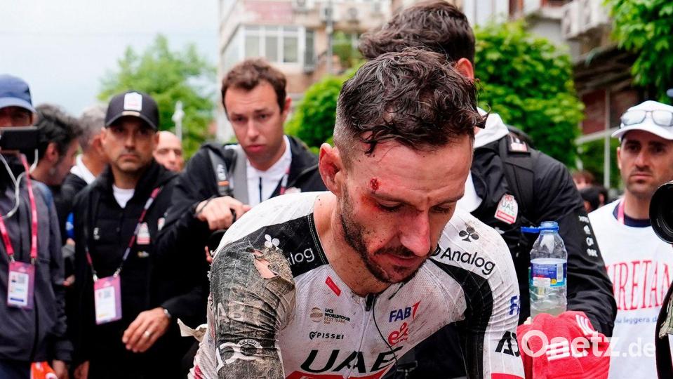 Trotz seines schweren Sturzes fuhr Adam Yates zunächst weiter. Bild: Fabio Ferrari/LaPresse/AP/dpa