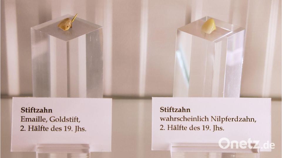 Stiftzähne in einem Schaukasten. Bild: Georg Wendt/dpa