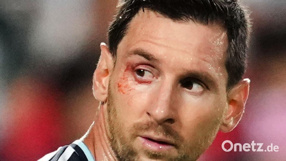 Wieder gezeichnet: Superstar Lionel Messi. Bild: Ed Zurga/AP/dpa
