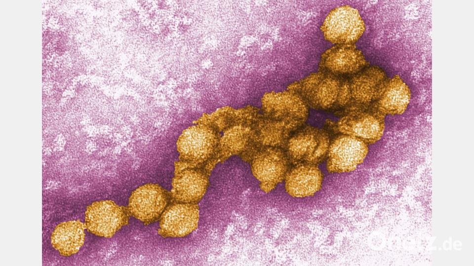 Das West-Nil-Virus unter dem Elektronenmikroskop. Bild: Cynthia Goldsmith/CENTERS FOR DISEASE CONTROL/EPA/dpa
