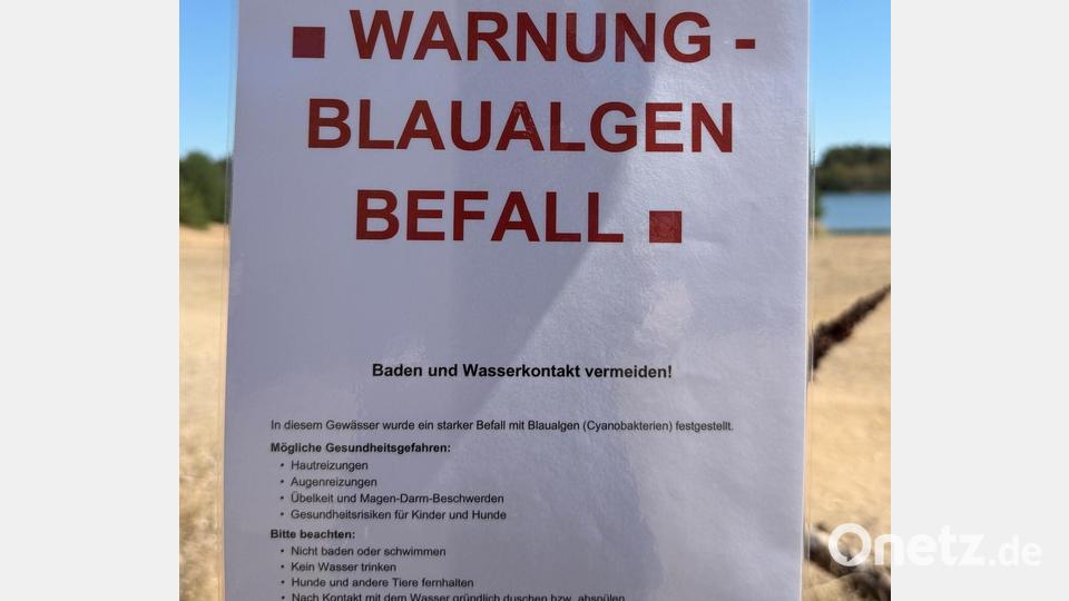 Am Dießfurter Weiher stehen Warnungen vor giftigen Blaualgen im Wasser. Bild: Gabi Schönberger