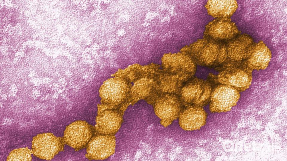 Das West-Nil-Virus unter dem Elektronenmikroskop. (Archivbild) Bild: Cynthia Goldsmith/CENTERS FOR DISEASE CONTROL/EPA/dpa