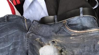 Bild: Polizei
Die Explosion riss ein Loch in die Jeans.