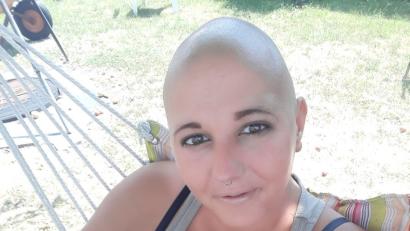 Bild: exb
Ein Selfie vom Sommer 2018. Theresa Baudler hat sich gerade den Kopf frisch rasiert. Mit ihrer Erkrankung geht sie weiterhin offen um.