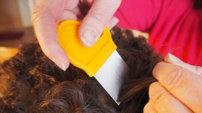 Bild: Bugl
Ein Kamm mit besonders engen Zähnen hilft, die lästigen Kopfläuse loszuwerden. Aber weil auch die Eier an den Haaren kleben, ist zusätzlich eine zweimalige Behandlung mit einem dafür zugelassenen Mittel erforderlich.