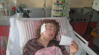 Bild: exb/ Claudia Brüderer
Schwer verletzt liegt Sophia Brüderer vor elf Jahren im Krankenhaus. Sie überlebt damals einen schlimmen Schulbusunfall bei Friedersreuth. Nun erzählt die heute 24-Jährige ihre Geschichte.