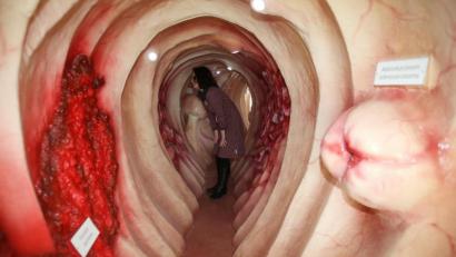 Symbolbild: Bodo Schackow
Ein begehbares Darm-Modell zeigt verschiedene Arten von Darmkrankheiten