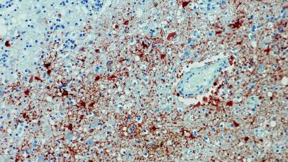 Anitkörpernachweis zum Borna-Virus im Gewebe. Foto: Bernhard-Nocht-Institut für Tropenmedizin/dpa