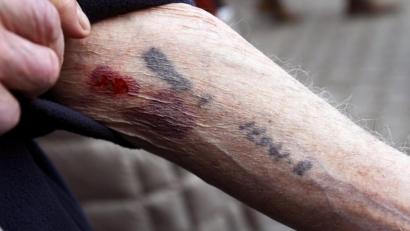 Bild: Emmi Korhonen/dpa
Noch gibt es Holocaust-Überlebende wie David Leitner, der seine tätowierten Häftlingsnummern während der Gedenkfeier zum 75. Jahrestag der Befreiung des ehemaligen Konzentrationslagers Auschwitz zeigt.