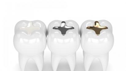 Bild: ©pictoores - stock.adobe.com
Verschiedene Zahnfüllungen