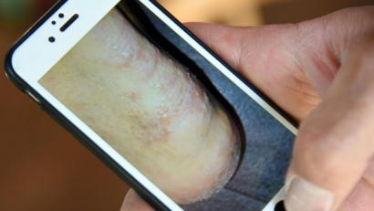 Symbolbild: Henning Kaiser
Krätze in Weiden? Der Vorsitzender des Vereins Handwerkerhaus glaubt an einen Lausbubenstreich.