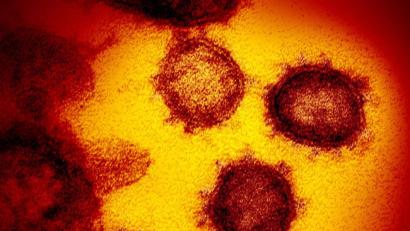 Bild: NIAID-RML/AP/dpa
Das neuartige Coronavirus (SARS-CoV-2). Die Probe wurde von einem Patienten in den USA isoliert.