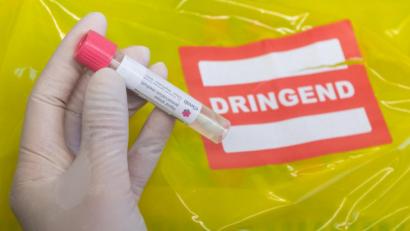 Bild: Robert Michael/dpa
Eine Probe wird für einen Coronatest vorbereitet. Das Ergebnis soll so schnell wie möglich vorliegen.