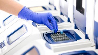 Bild: Synlab
Die Zahl der positiven Tests nimmt weiter nur gebremst zu.