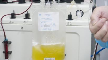 Bild: Cai Yang
Gespendetes Plasma eines geheilten Coronavirus-Patienten wird in einem Plasmabeutel aufgefangen. Foto: Cai Yang/XinHua/dpa/Symbolbild
