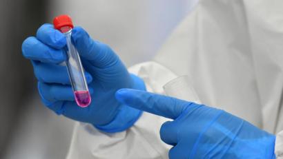 Archivbild: Hendrik Schmidt/dpa-Zentralbild/ZB
Eine weitere Infektion mit dem Coronavirus meldete das Landratsamt Schwandorf am Donnerstag.