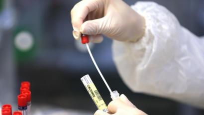 Symbolbild: Oliver Berg/dpa
Ein Wattestäbchen eines Corona-Abstriches wird in einem Labor bearbeitet.