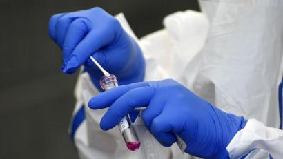 Bild: exb/Hendrik Schmidt
Ein Test brachte Gewissheit, was eine 31-jährige Amberg-Sulzbacherin ohnehin schon ahnte: Sie hatte sich vor einigen Wochen mit dem Coronavirus infiziert.