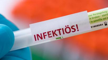Bild: Hendrik Schmidt/dpa
Die Probe für einen Coronatest.