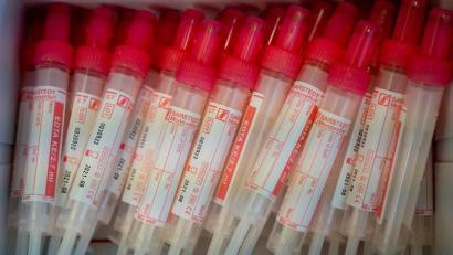 Bild: Peter Kneffel/dpa
Proberöhren für die Blutentnahme liegen in einer Verpackung. Jeder soll sich in Bayern auf das Corona-Virus testen lassen können. Foto: Peter Kneffel/dpa