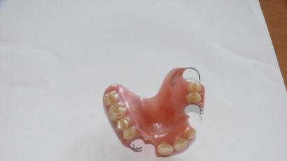 Bild: exb
Dieses Gebiss blieb am Dienstagvormittag am Bahnhof liegen. Der Eigentümer kann es beim Fundamt der Stadt Amberg abholen.