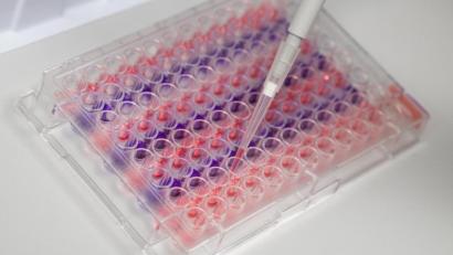 Symbolbild: Christophe Gateau
Ein Laborant arbeitet mit einer Pipette im Institut für Virologie an der Charité Berlin Mitte, in dem Untersuchungen zum Coronavirus laufen.
