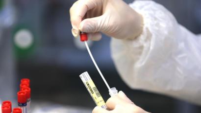 Bild: Oliver Berg
Ein Wattestäbchen eines Corona Abstriches wird im Labor bearbeitet. Foto: Oliver Berg/dpa/Symbol