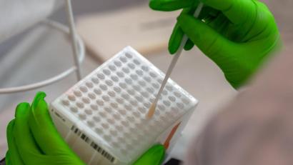 Symbolbild: Robert Michael/dpa
Eine Mitarbeiterin arbeitet an der Einsortierung der Wattestäbchen für den Typisierungsprozess der DNA.