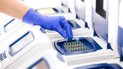 Symbolbild: Synlab
Das Gesundheitsamt meldet am Montag keine weitere belegte Neuinfektion mit dem Coronavirus für Weiden und den Landkreis Neustadt.