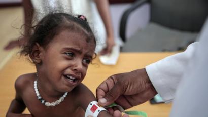 Bild:  Hani Mohammed
Ein Arzt misst den Armumfang eines unterernährten Mädchens im Aslam Health Center im Jemen. Die Vereinten Nationen bezeichnen den Krieg im Jemen als die größte humanitäre Katastrophe der Gegenwart.