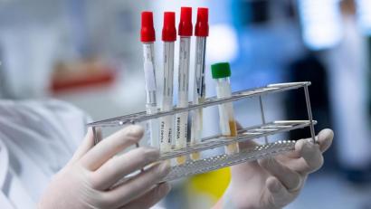 Bild: Sven Hoppe
Eine Laborantin bereitet Corona-Proben für die weitere Analyse vor. Foto: Sven Hoppe/dpa/Symbolbild