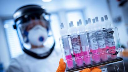 Symbolbild: Peter Steffen/dpa
Coronavirus-Testproben in einem Labor. Im Landkreis Neustadt haben zwischen dem 3. und 9. November 122 Proben ein positives Ergebnis gebracht.