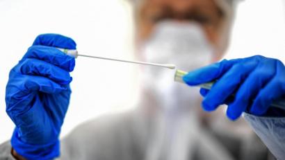 Symbolbild: Britta Pedersen
Ein Abstrichstäbchen wird in einer ambulanten Corona-Test- Einrichtung gehalten.