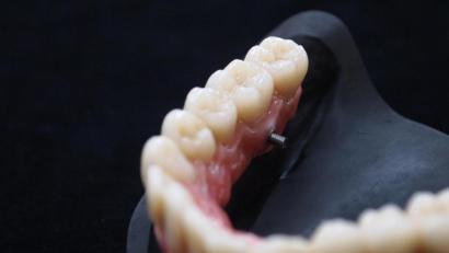 Bild: exb
Zahnersatz und Implantate – auch in diesem Bereich hat längst die digitale Technik Einzug gehalten. Und das "dental team" gehört hier zu den führenden Labors deutschlandweit