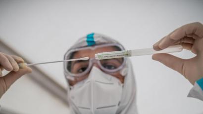 Symbolbild: Michael Kappeler / dpa
PCR-Tests werden nach Online-Terminvereinbarung für alle interessierten Bürger aus Weiden und dem Landkreis Neustadt/WN im Testzentrum Neustadt-Weiden durchgeführt. Kurz vor Weihnachten allerdings wurden einige Testwillige wieder nach Hause geschickt – trotz Termin.