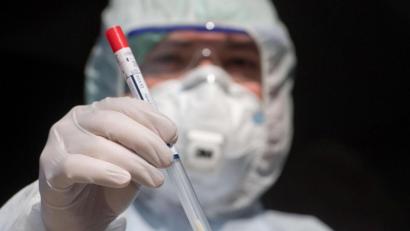 Symbolbild: Stefan Sauer
Wieder steigt die Zahl der nachweislich an Corona Infizierten in Weiden und im Landkreis Neustadt. Aber die Inzidenzen nähern sich an.