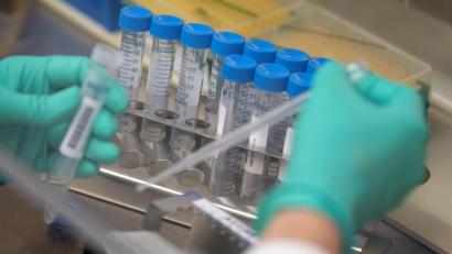 Symbolbild: Marijan Murat/dpa
Eine Mitarbeiterin des Landesgesundheitsamts Baden-Württemberg pipettiert Coronaproben. Bei vielen Infektionskrankheiten gilt: Hat ein Patient die Erkrankung hinter sich, ist er einige Zeit vor dem Erreger geschützt. Bei Corona gibt es dazu bislang aber kein klares Ergebnis.