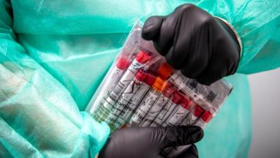 Symbolbild: Sina Schuldt/dpa
Proben für einen PCR-Test werden von einem Laboranten verpackt.