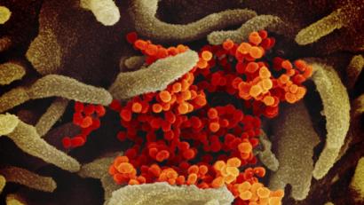 Bild: NIAID-RML/dpa
Eine elektronenmikroskopische Aufnahme des "U.S. National Institute of Health" zeigt das neuartige Coronavirus (SARS-CoV-2) (orange), das aus der Oberfläche von im Labor kultivierten Zellen (grau) austritt.