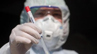 Symbolbild: Stefan Sauer/dpa
Nur zwei Neuinfektionen mit dem Coronavirus wurden zwischen Montag und Dienstag in Weiden und dem Kreis Neustadt/WN nachgewiesen.