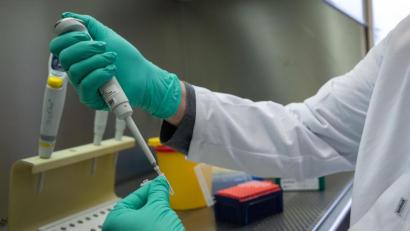 Symbolbild: Sebastian Gollnow/dpa
Ein Forscher zeigt im Landesgesundheitsamt Baden-Württemberg, wie ein PCR-Test für die Analyse auf Mutationen des Coronavirus vorbereitet wird.