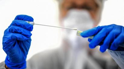 Symbolbild: Britta Pedersen/dpa
Die Corona-Fallzahlen in Weiden und im Kreis Neustadt sind leicht rückläufig. Im Landkreis gibt es jedoch einen neuen Todesfall in Zusammenhang mit dem Virus.