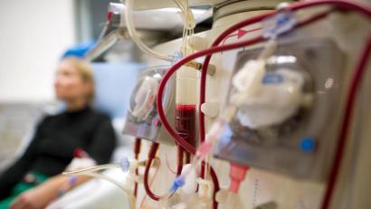 Symbolbild: Arno Burgi/dpa
Am Dialysezentrum Kemnath werden täglich etwa 50 Dialysepatienten behandelt.