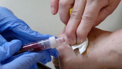 Archivbild: tr
Insgesamt 5,5 Milliliter werden jedem Probanten für die Corona-Studie entnommen.