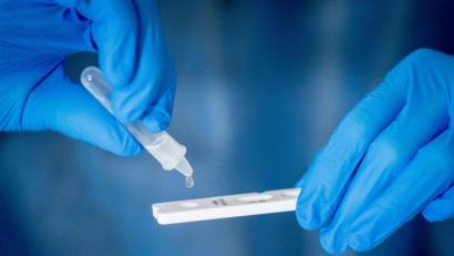 Bild: dpa/Kay Nietfeld
Infiziert oder nicht? Das verrät der Corona-Schnelltest.