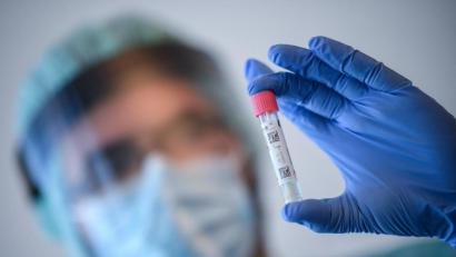 Symbolbild: Britta Pedersen/dpa
Bei fünf Menschen aus dem Landkreis Neustadt/WN wurde zwischen Montag und Dienstag eine Neuinfektion mit dem Coronavirus nachgewiesen.